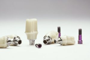 implanty dentystyczne