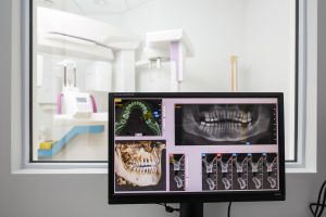 diagnostyka stomatologiczna z pomoca metod komputerowych