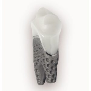 implant anatomiczny stomatologiczny