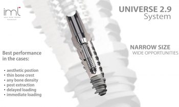 Universe 2.9 – ultranowoczesny szwajcarski implant zębowy zaprojektowany przez Dyrektora Medycznego Maestria Clinic